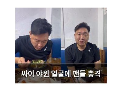 싸이 야윈 얼굴에 팬들 충격